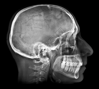 头骨骼人类头骨X光图像扫描x光医生脖子脊柱男人考试放射科骨骼解剖学背景