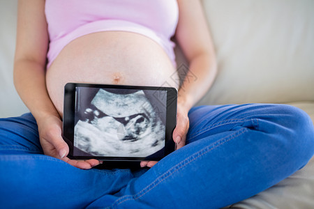 显示超声波扫描的孕妇住所服装休闲沙发闲暇超声孕妇装怀孕待产客厅背景图片