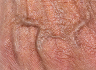 80年代老一个老太婆的手拇指宏观曲线生活身体退休女士皱纹静脉老年背景