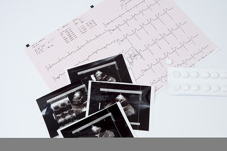 体格检查诊断诊所x光医书药品脉动科学维生素申请表心脏病背景图片
