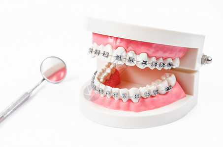 带金属丝牙套和镜子牙科设备的牙齿模型外科治疗诊所假牙扣子手术夹子牙医保险畸形背景图片