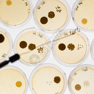 培里迪塞斯的细菌在成长盘子宏观生物拭子细胞化学微生物生长保健菌类病理高清图片素材