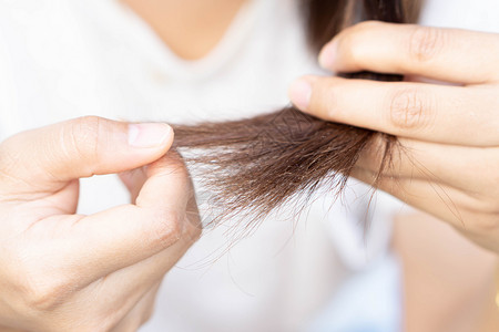 枕秃妇女因保健洗发水和beau而严重理发问题造型师发型假发头皮男性损失生长移植头发医疗保险背景
