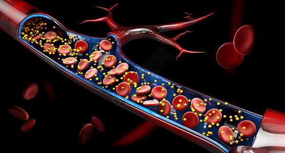 血钙3d 血液血管中的钙含量说明插图动脉疾病血液学血栓溪流血流管子测试显微镜背景
