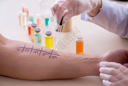 过敏测试医生检测住院病人的过敏性反应敏化卫生免疫学专家红斑药品实验室表皮手臂考试背景