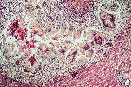 100x组织内含有寄生虫蛋的鹿荒野疾病老兵专用病理医药宏观考试狍子科学背景图片