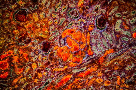 肾脏组织 肾上腺囊组织 出血100次科学疾病肾细胞暗场宏观肾体细胞组织学病理背景图片