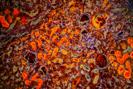 肾脏组织 肾上腺囊组织 出血100次宏观科学暗场病理肾体细胞肾细胞疾病组织学背景图片