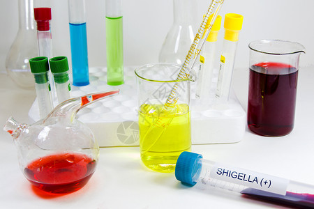 溶血性链球菌Shigella细菌 血液测试管样本 阳性检测诊断背景