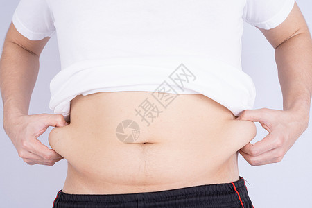 吃坏肚子胖子拿着过多的脂肪腹部 超重的脂肪腹部孤立的灰色背景 饮食生活方式 减肥 胃肌 健康理念压力损失展示烧伤橘皮肥胖检查肚子白色身体背景