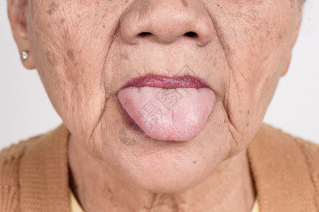 80年代老老年妇女的嘴女士保健成人药品裁剪舌头牙科皮肤卫生化妆品背景