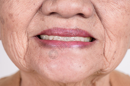 80年代老老年妇女微笑的年长妇女情感保健卫生女士假牙皮肤老化牙科牙齿药品背景