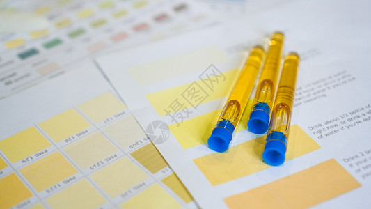 尿管被贴在彩色图表上 分析 诊断等概念审查尿素考试早餐医生肾脏尿酸持有者服务感染背景图片