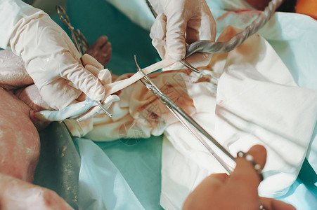 医生抱着新生婴儿 而另一名医生割断了紧急脉冲医院哭泣分娩剪刀童年药品生活母亲外科母性可爱的高清图片素材