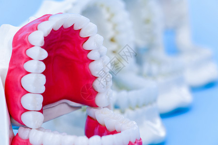 牙医正畸牙齿模型外科卫生技术药品解剖学医生治疗科学牙龈手术图片
