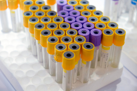 纤维蛋白医疗采样管管子化学品医生测试样本紫色肝素诊断贮存科学背景