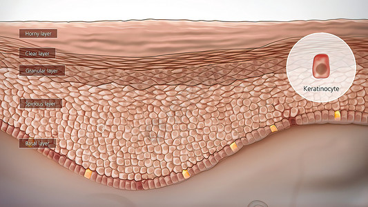 饼状分类图表皮肤解解剖结构卵泡晒斑疼痛器官生物学头发身体表皮事故细胞背景