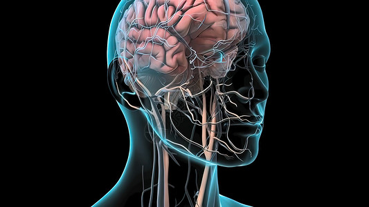 头部血管素材脑损伤造成脑出血 导致脑出血中风牌匾动脉粥样硬化压力血细胞红色心脏病学封锁器官液体背景