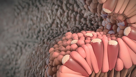 尿路上皮癌遗传生活高清图片