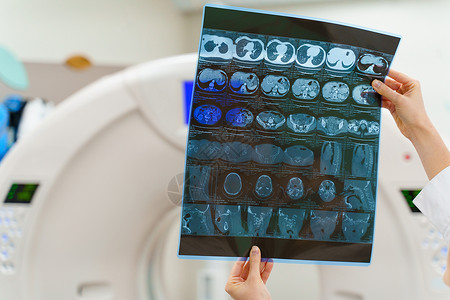 学情分析计算机断层摄影仪器研究教学方法 X射线照片掌握在手 背景情况CT背景