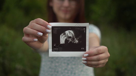 年轻孕妇手上拿着一个婴儿的超声波照片 而女孩是天生的人们高清图片素材