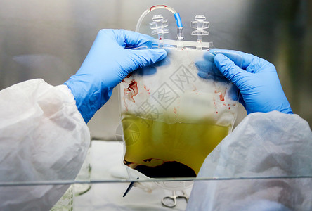 羊血被手套手隔离的胎盘带血库捐赠血液单位 由手套手制备学习尺寸生物学通风柜显微科学组织学病理低温箱分娩背景
