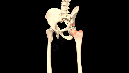 腿骨解剖学事故风湿病扭伤生理骨科疼痛治疗股骨身体膝盖图片