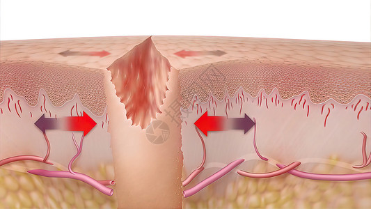 纤维蛋白3D 皮肤伤口愈合时间的医疗说明胶原改造组织静脉血管皮肤科真皮润肤图层制粒背景