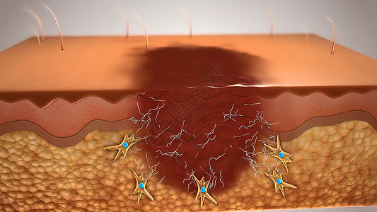 皮肤伤口愈合康复图层血管纤维动脉静脉制粒润肤图表细胞图片