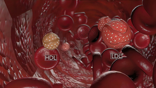 血氧计模型胆固醇血症高清图片