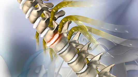 强壮骨骼3D型医疗盘片保健外科脊柱脖子尺寸科学身体疾病腰椎光盘背景