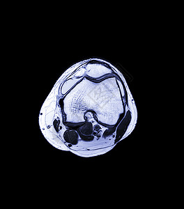 MRI Knee 联合三观点医生扫描器创伤骨科医院卫生髌骨诊所核磁共振检查健康高清图片素材