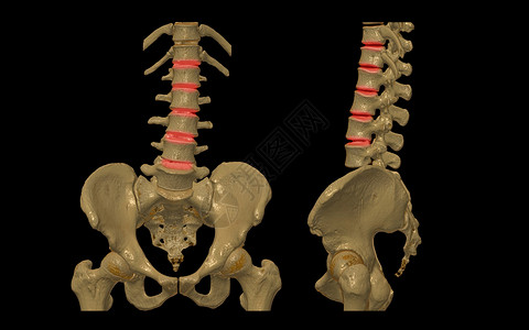 CT 腰椎或 LS 脊柱 3D 渲染图像 AP 和侧视图 3D 插图图片