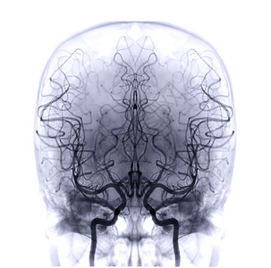 小动脉CT扫描医疗的高清图片