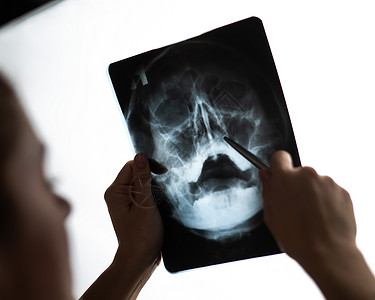 医生检查鼻腔的X光片解剖学保健扫描放射科专家x光断层诊所x射线鼻窦图片