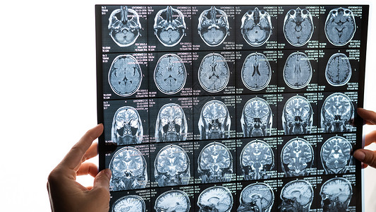 女医生检查脑部核磁共振扫描技术谐振医院x射线疾病诊断器官医师病人电影图片