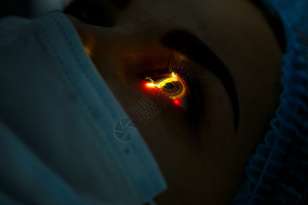 医疗激光眼睛矫正 医学技术眼科手术 掌声角膜外科医生测试光束近视实验室治疗诊所药品背景图片