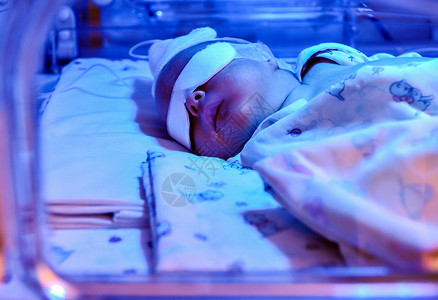 孵化器中紫外灯下的新生儿婴儿高清图片