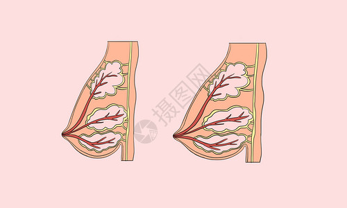 脂肪细胞女性丰胸设计图片