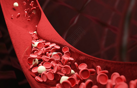 血管壁血管狭窄设计图片