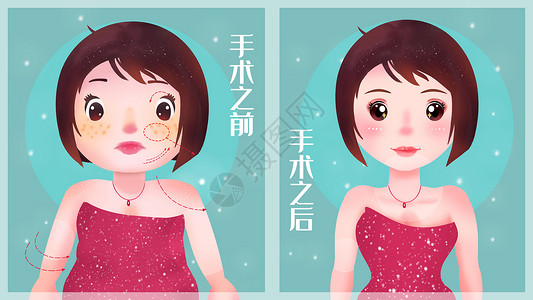 美白针整形广告整容蜕变插画