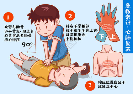 医学常识急救心肺复苏插画