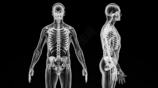 右侧股骨X光人体骨骼场景设计图片