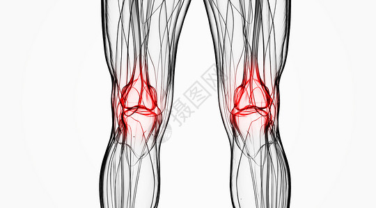 髌骨X光关节炎场景设计图片