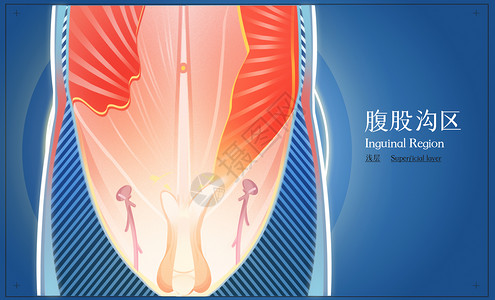 男性生殖系统男性腹股沟区浅层医疗插画插画