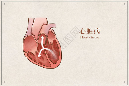 心脏病医疗插画示意图心血管内科高清图片素材