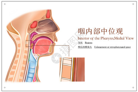 摸喉咙咽内部中位观分区和咽后间隙医疗插画插画