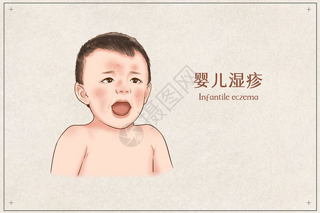 给婴儿擦嘴婴儿湿疹医疗插画示意图插画