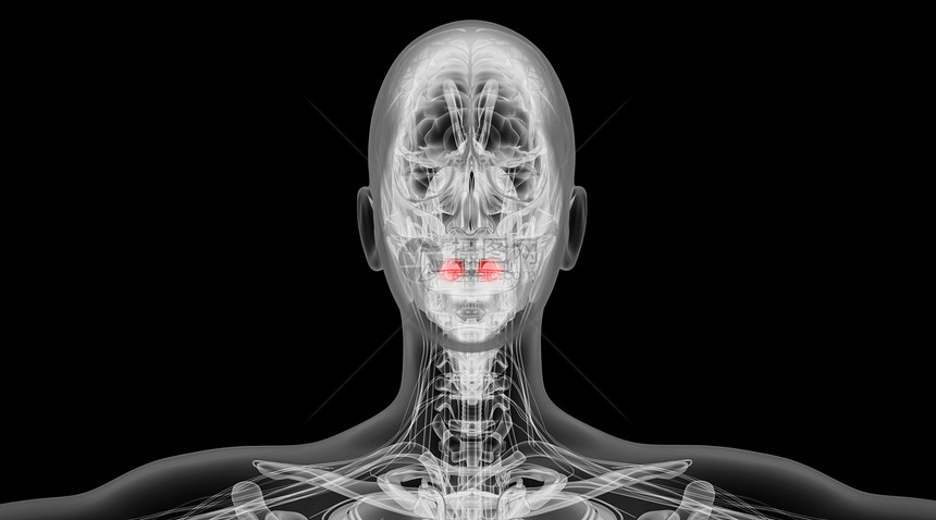 X光人体扁桃腺发炎场景图片