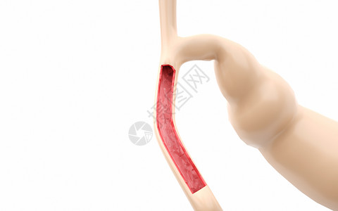 袖珍小刀人体器官胆总管剖面结构设计图片